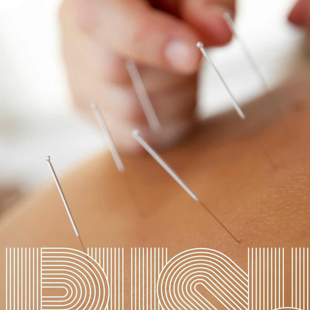 You are currently viewing Acupuncture for Menopause and Perimenopause: A Natural Path to Hormonal Balance